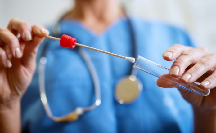Close up of nurses hands holding buccal cotton swab and test tube ready to collect DNA from the cells. Tamponi OSS
